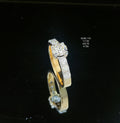 1.72 CT RING solitaire diamonds 18k